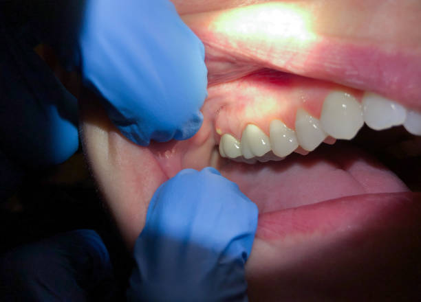 Best Same-Day Emergency Dentist in North Lakeport, CA