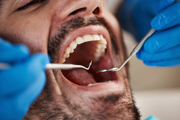 Best Emergency Treatment for Toothache in North Lakeport, CA