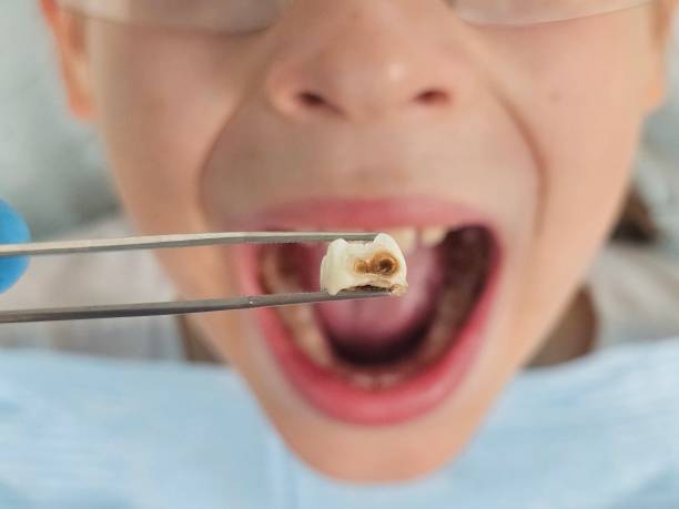 Best After-Hours Emergency Dentist in North Lakeport, CA