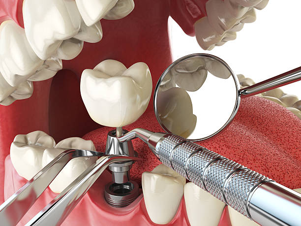 Best Same-Day Emergency Dentist in North Lakeport, CA